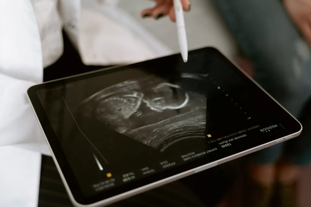 Tablet device being used by doctor with ultrasound image on the screen.